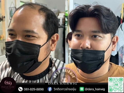 วิกผมผู้ชายติดกาว